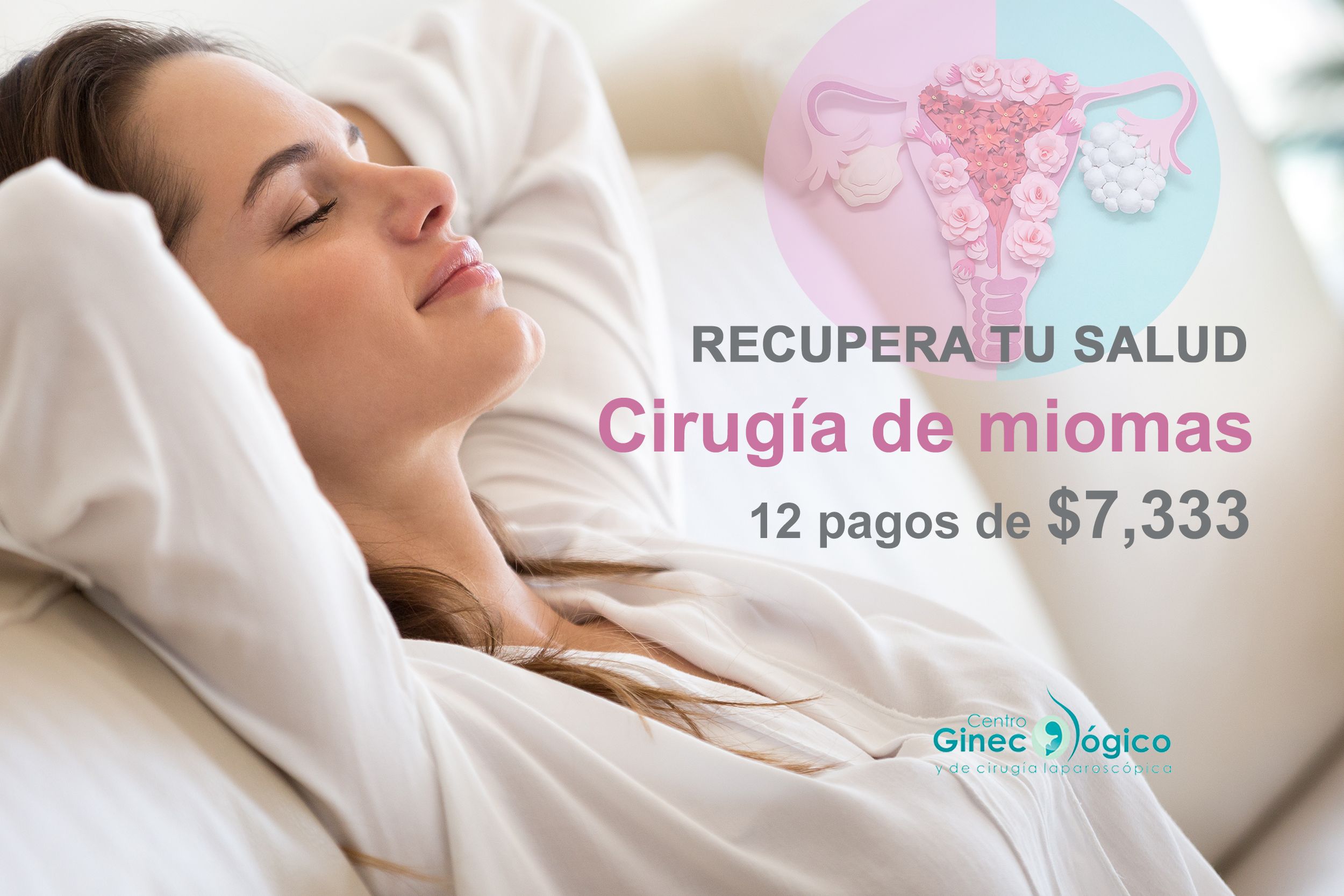 Cirugía de miomas cdmx